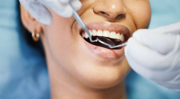 Best Knocked-Out Tooth Emergency  in Storrs, CT