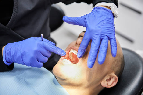 Best Cracked Tooth Emergency Dentist  in Storrs, CT