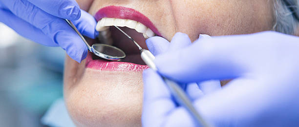 Best Emergency Gum Pain Relief  in Storrs, CT